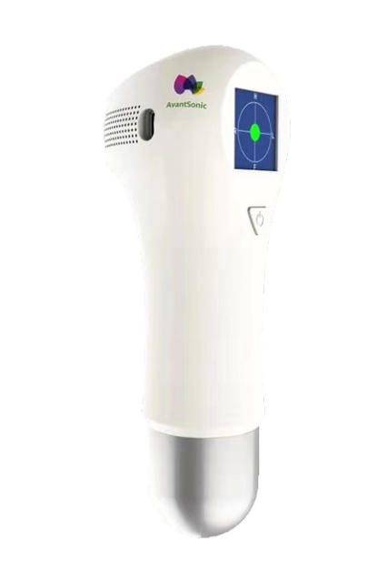 Avantsonic AS-2 Portable Bladder Scanner – Non-Invasive Ultrasound Bladder Volume Measurement