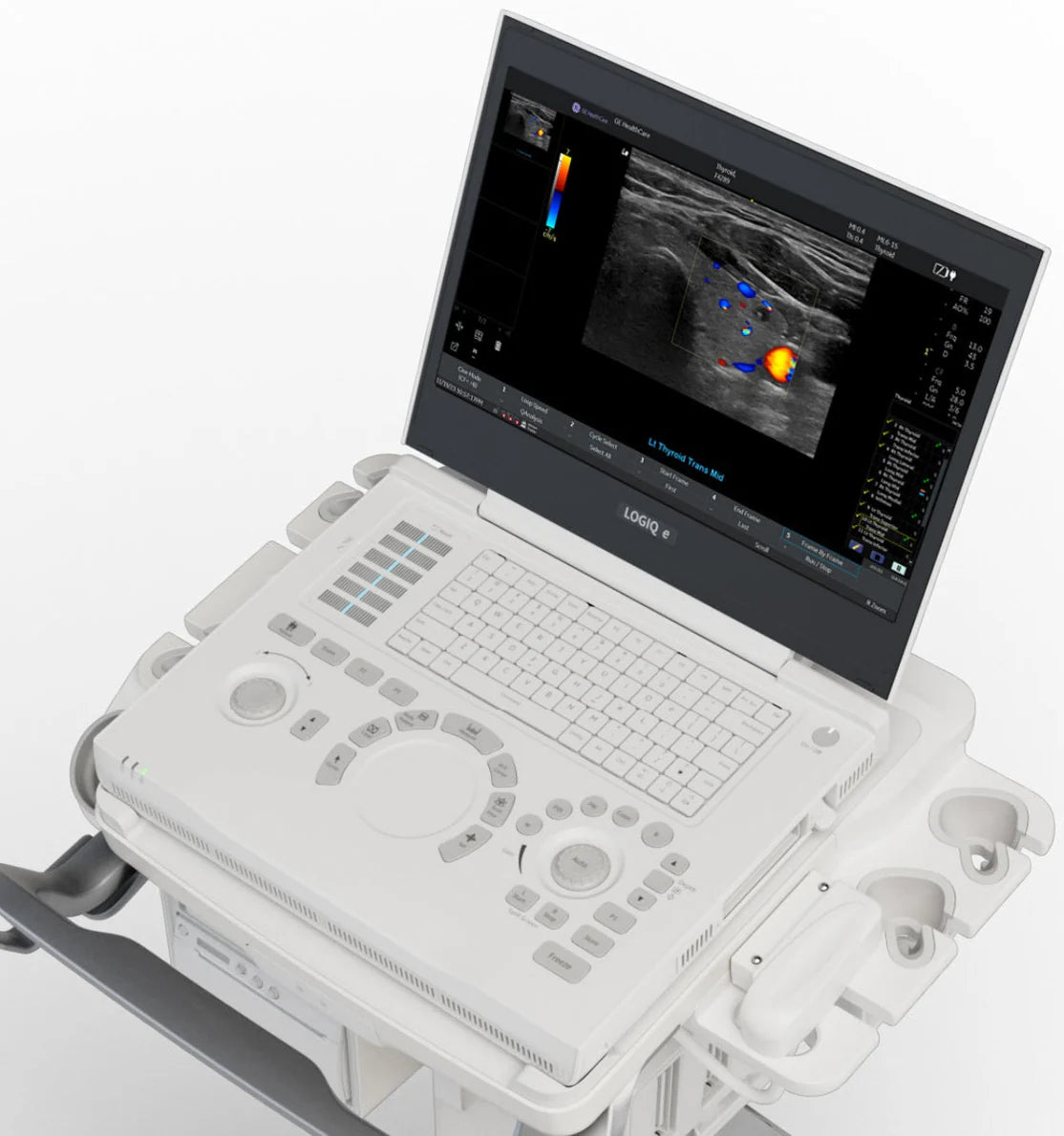 GE Logiq e Standard Package