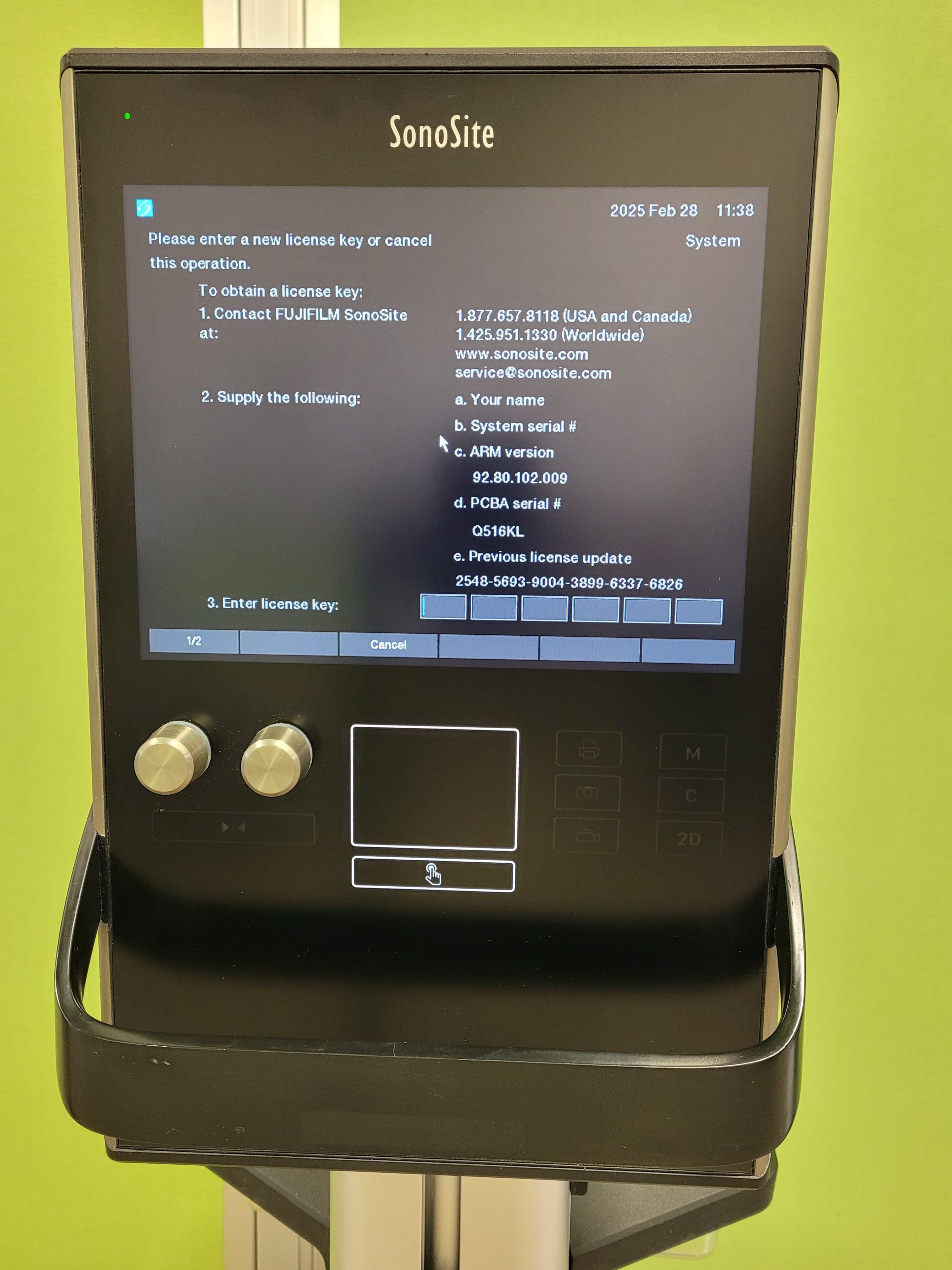 SonoSite S2 SII Ultrasound System