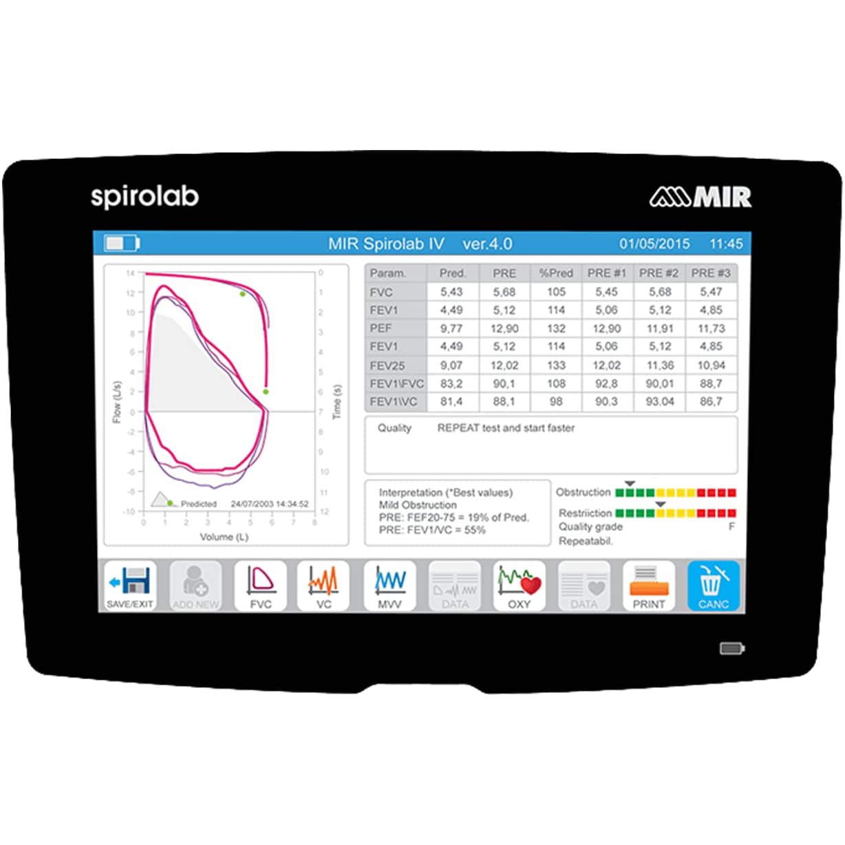 MIR  Spirolab Spirometer Desktop with 7" Screen | QuinceMedical.com