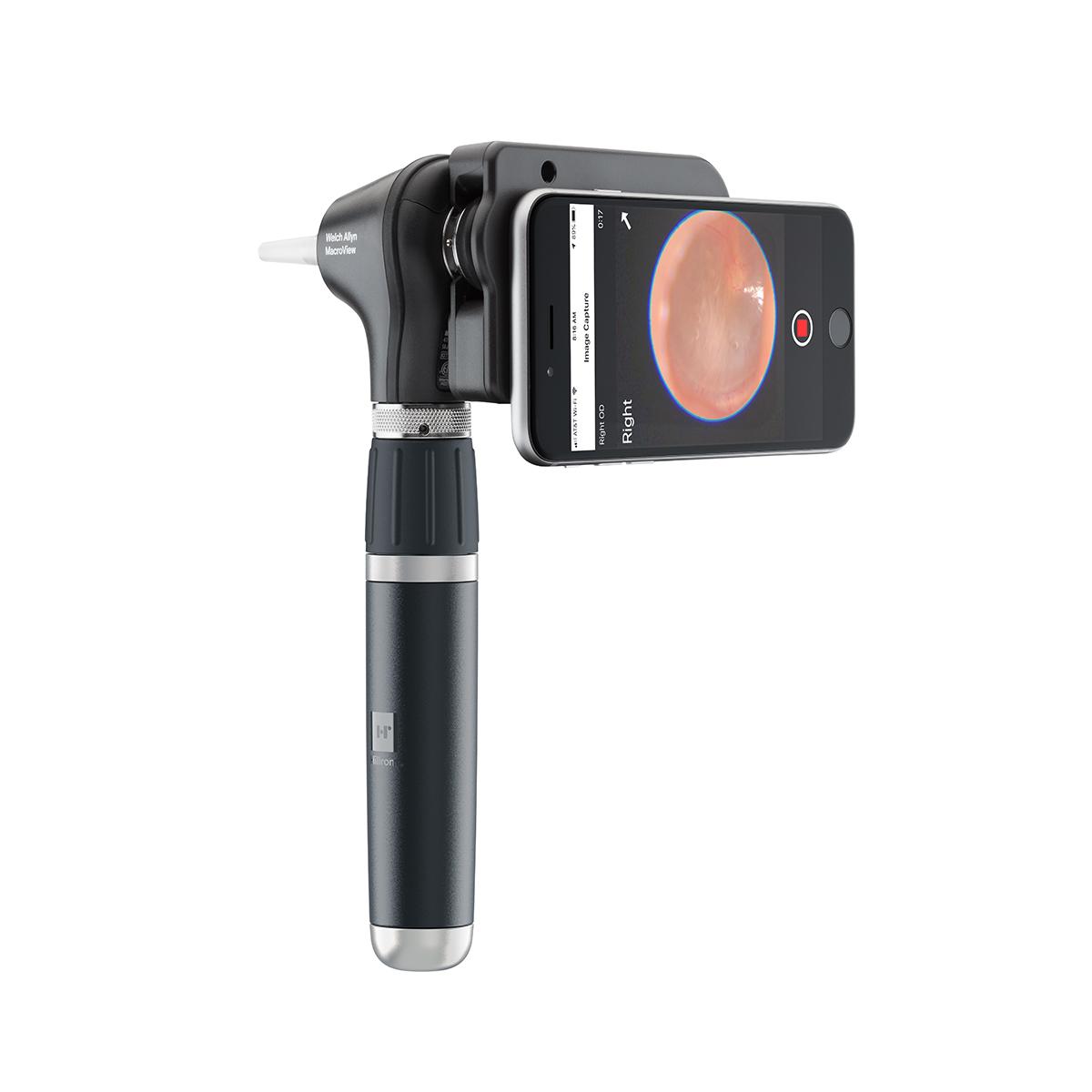 Welch Allyn MACROVIEW PLUS Otoscope