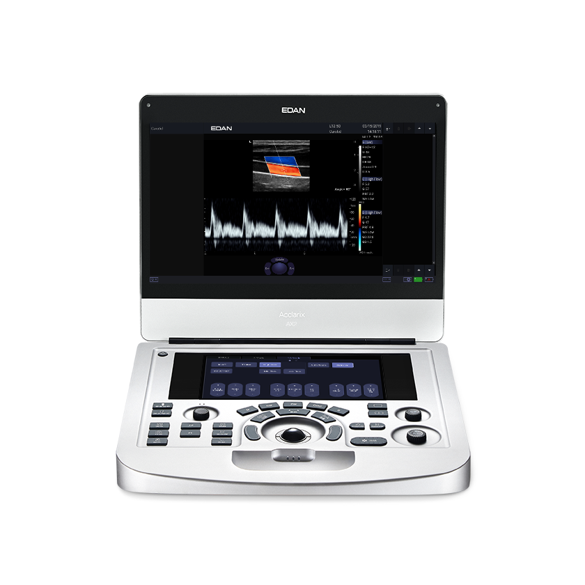 Edan Acclarix AX2 Diagnostic Ultrasound System