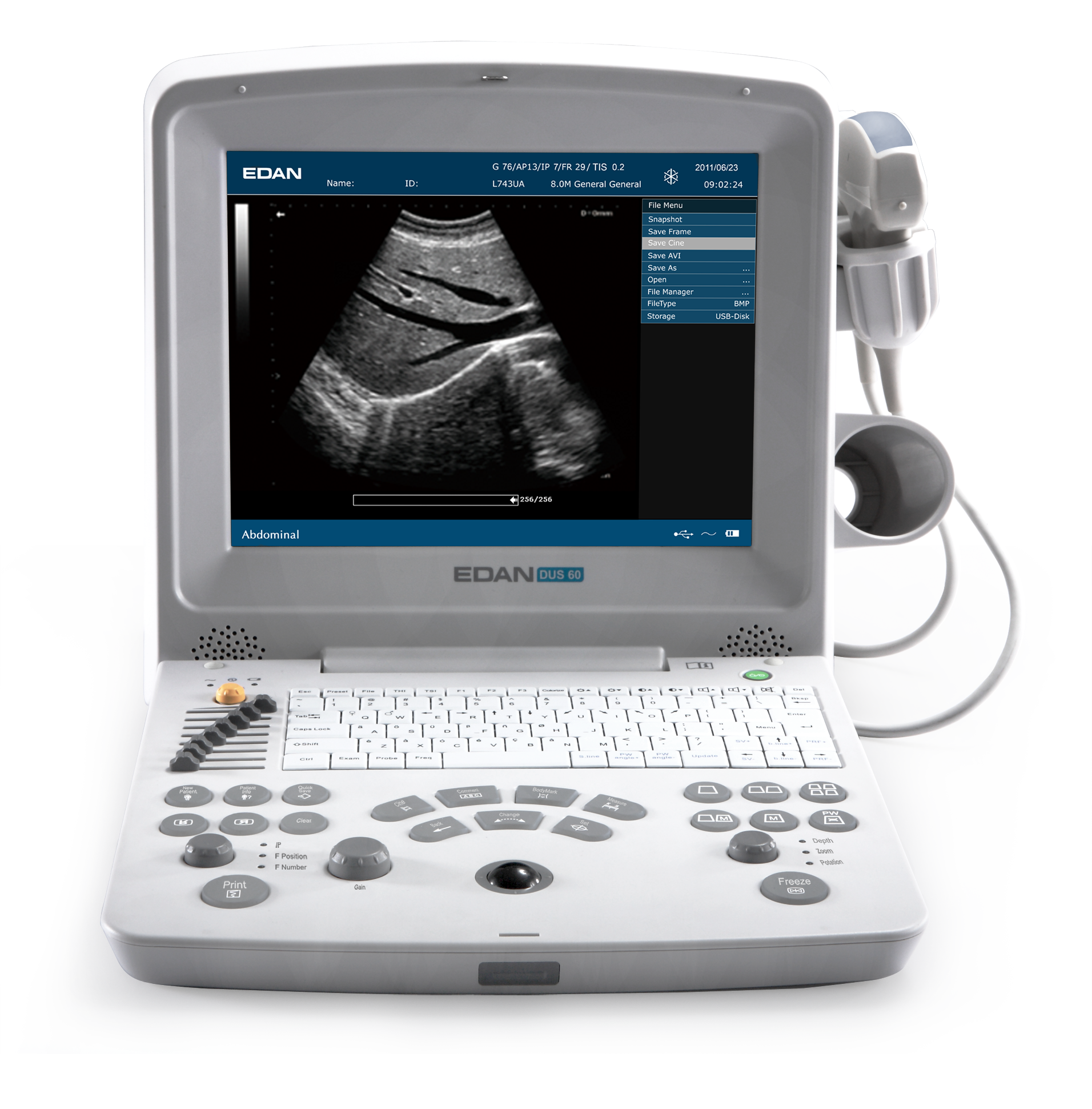 Edan DUS60 Digital Ultrasonic Diagnostic Imaging System