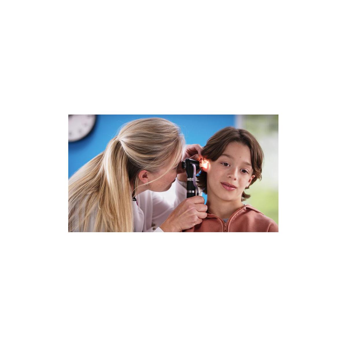 Welch Allyn MACROVIEW PLUS Otoscope