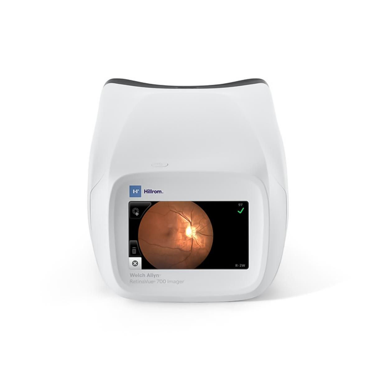 Welch Allyn RetinaVue 700 Imager (RV700-B) | Quince Medical