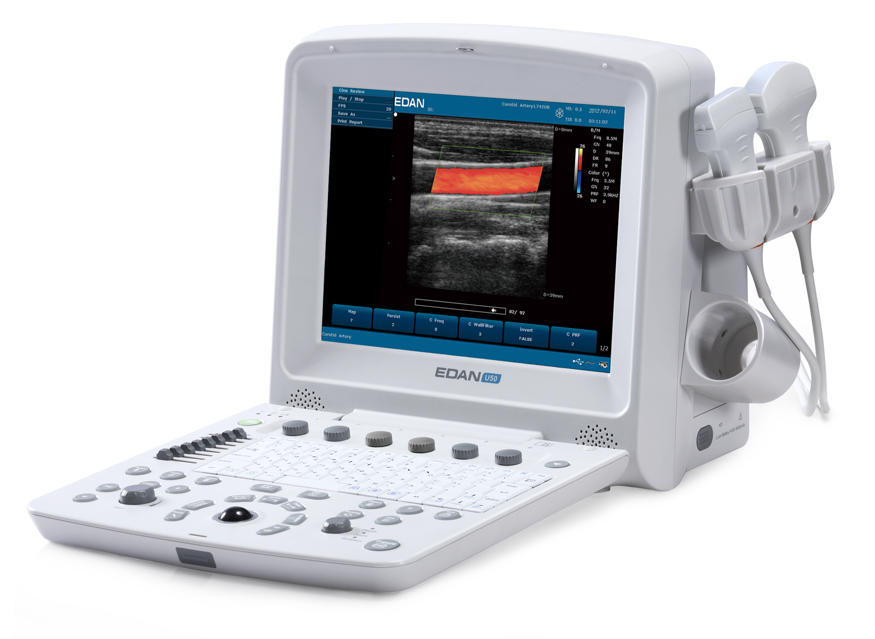 Edan U50 prime edition Diagnostic Ultrasound