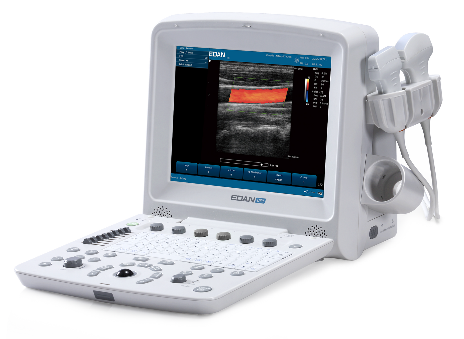 Edan U50 prime edition Diagnostic Ultrasound