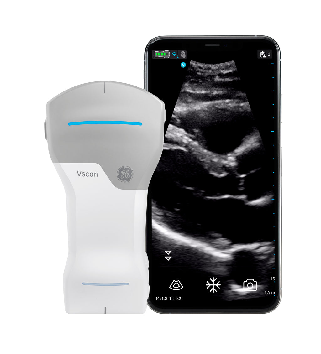 Vscan Access, a Portable Ultrasound Device for Vscan Access, a Portable Ultrasound Device for