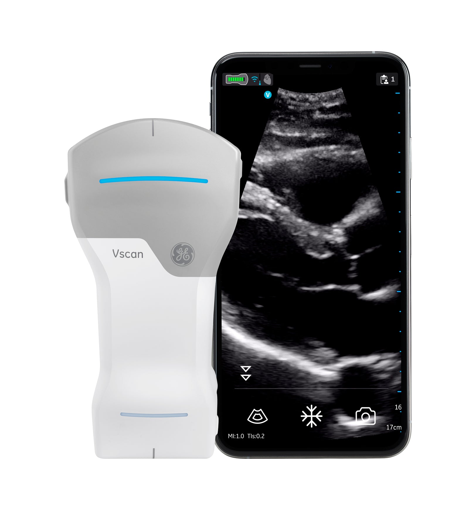 Vscan Air CL Parasternal Long Axis
