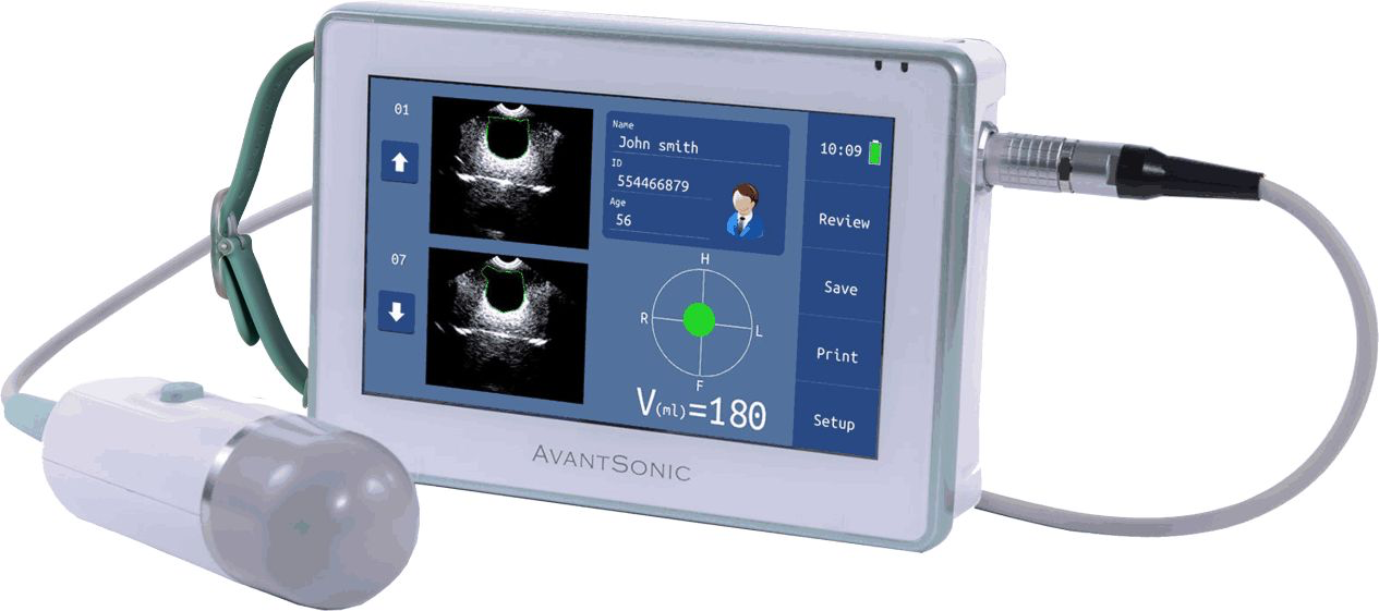 AvantSonic Z3 Portable 3D Bladder Scanner – 7″ Touchscreen | Quince Medical