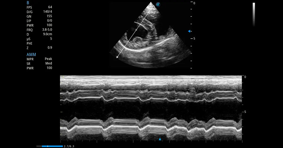 GE Anatomical M Mode Option
