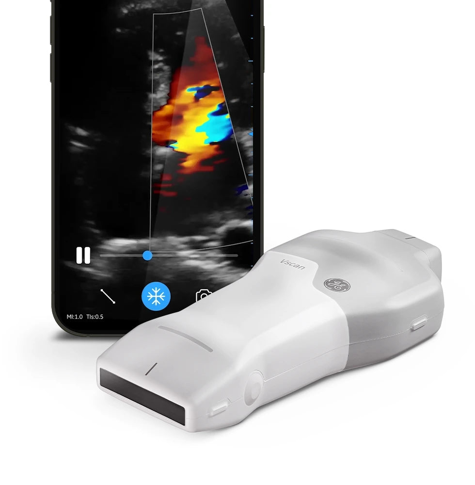 GE Vscan Air™ SL Ultrasound System GEM H3034VP | QuinceMedical.com