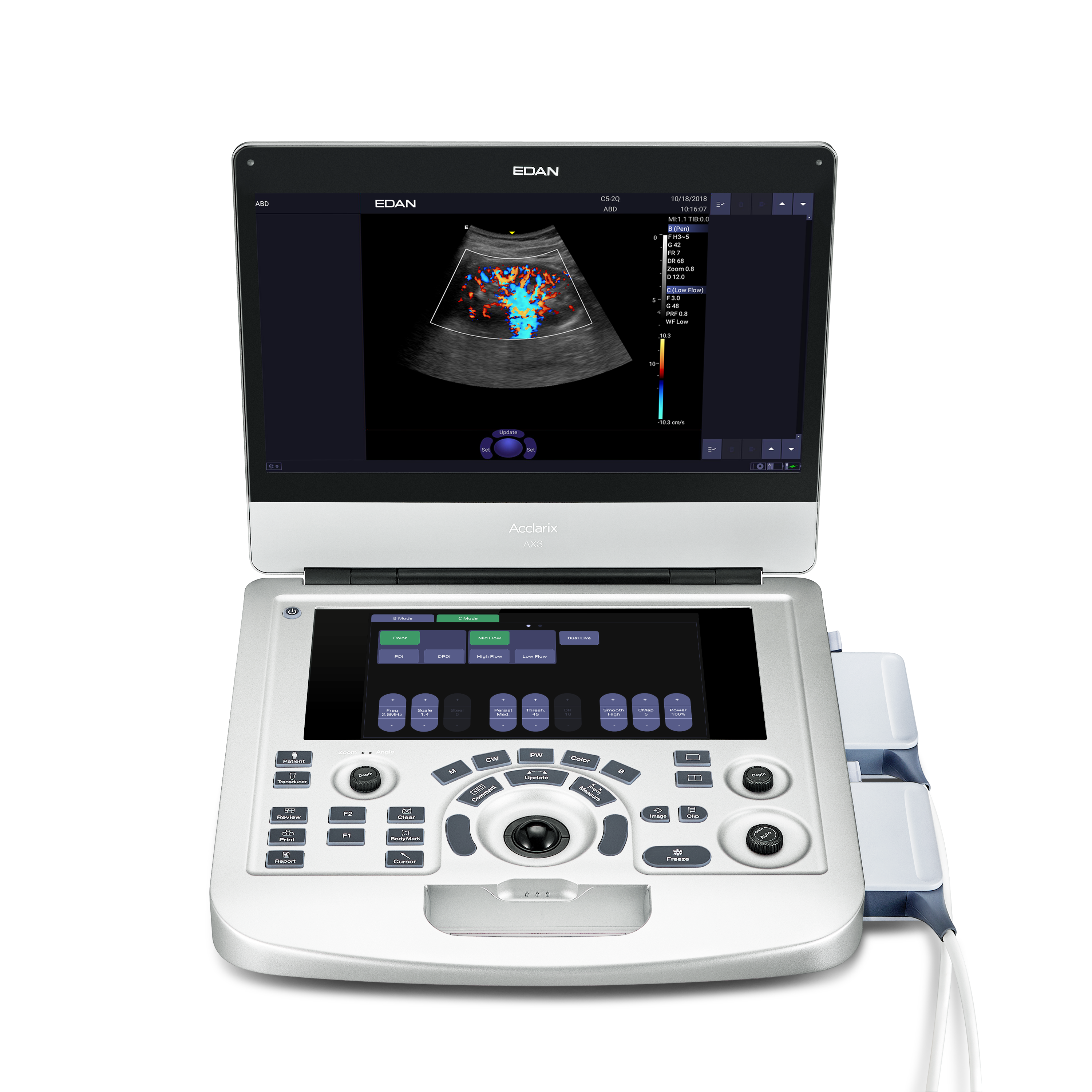 Edan Acclarix AX3 Diagnostic Ultrasound System