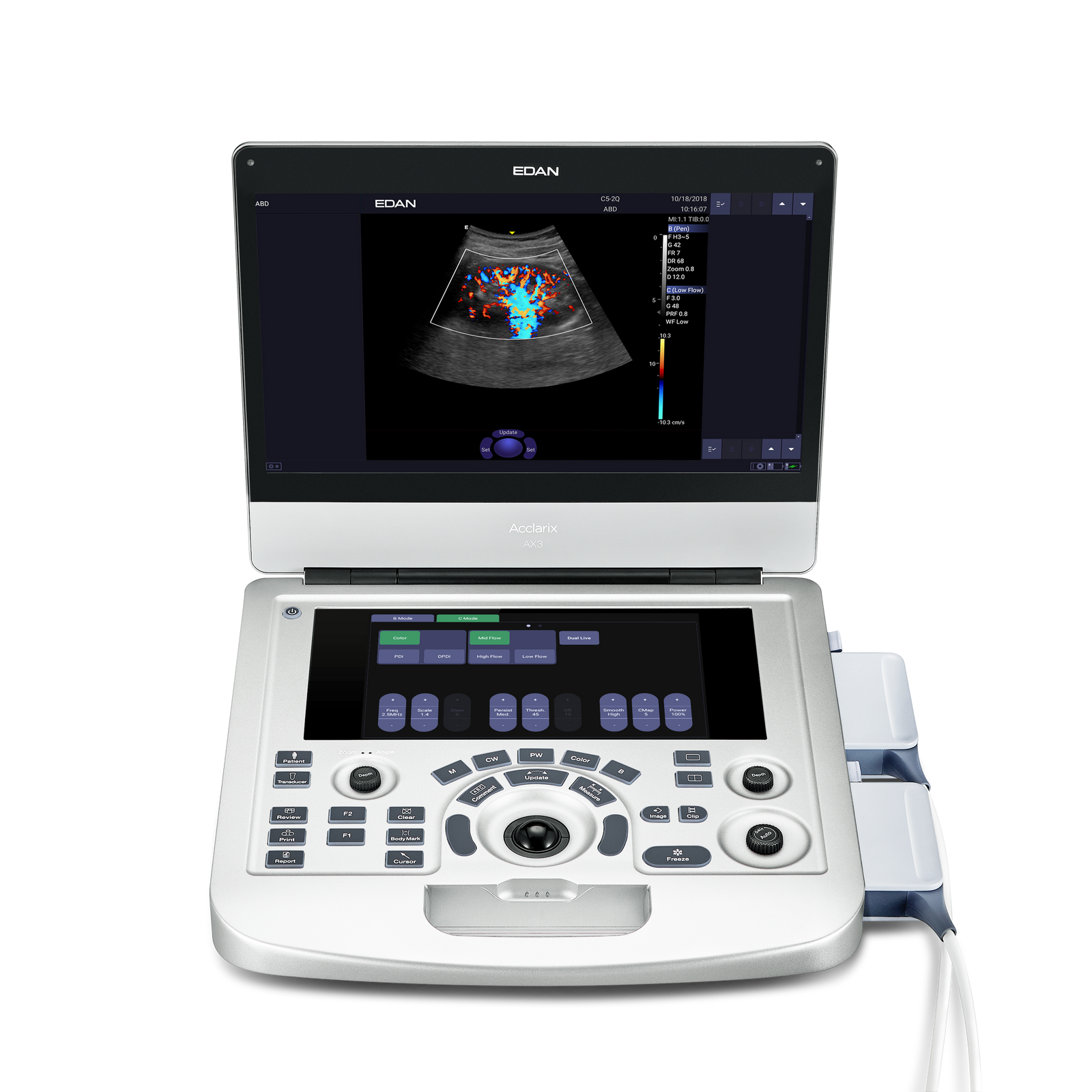 Edan Acclarix AX3 Diagnostic Ultrasound System