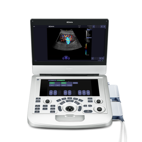 その他 Helix Signature AES3 Digital Edan Acclarix AX3 Diagnostic Ultrasound System