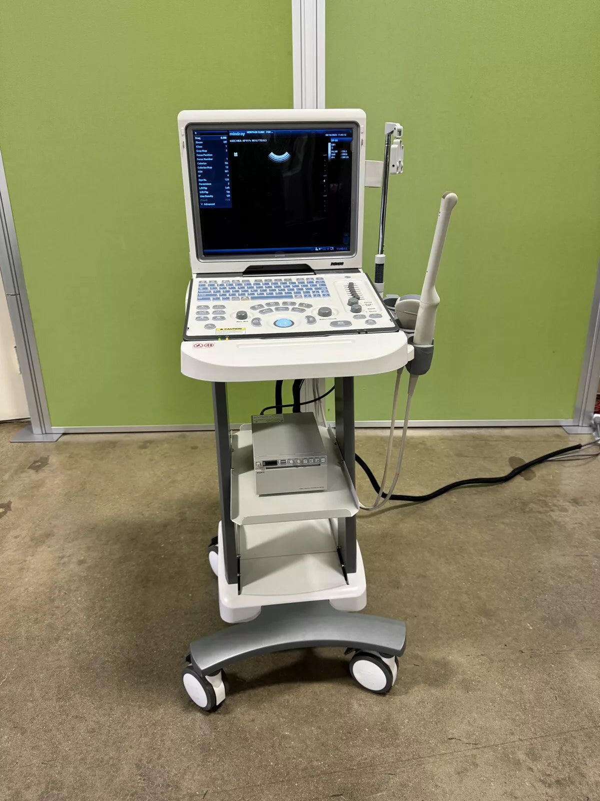 Mindray DP-50 Ultrasound System