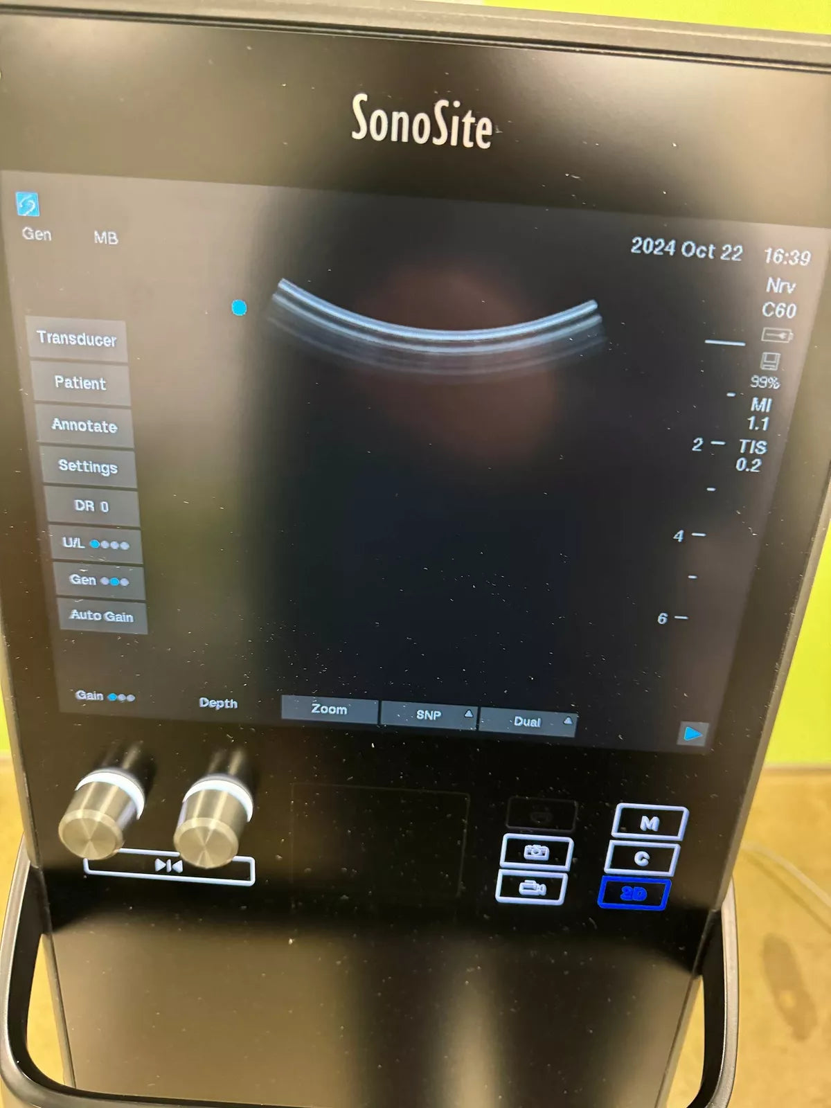 SonoSite S2 SII Ultrasound Machine