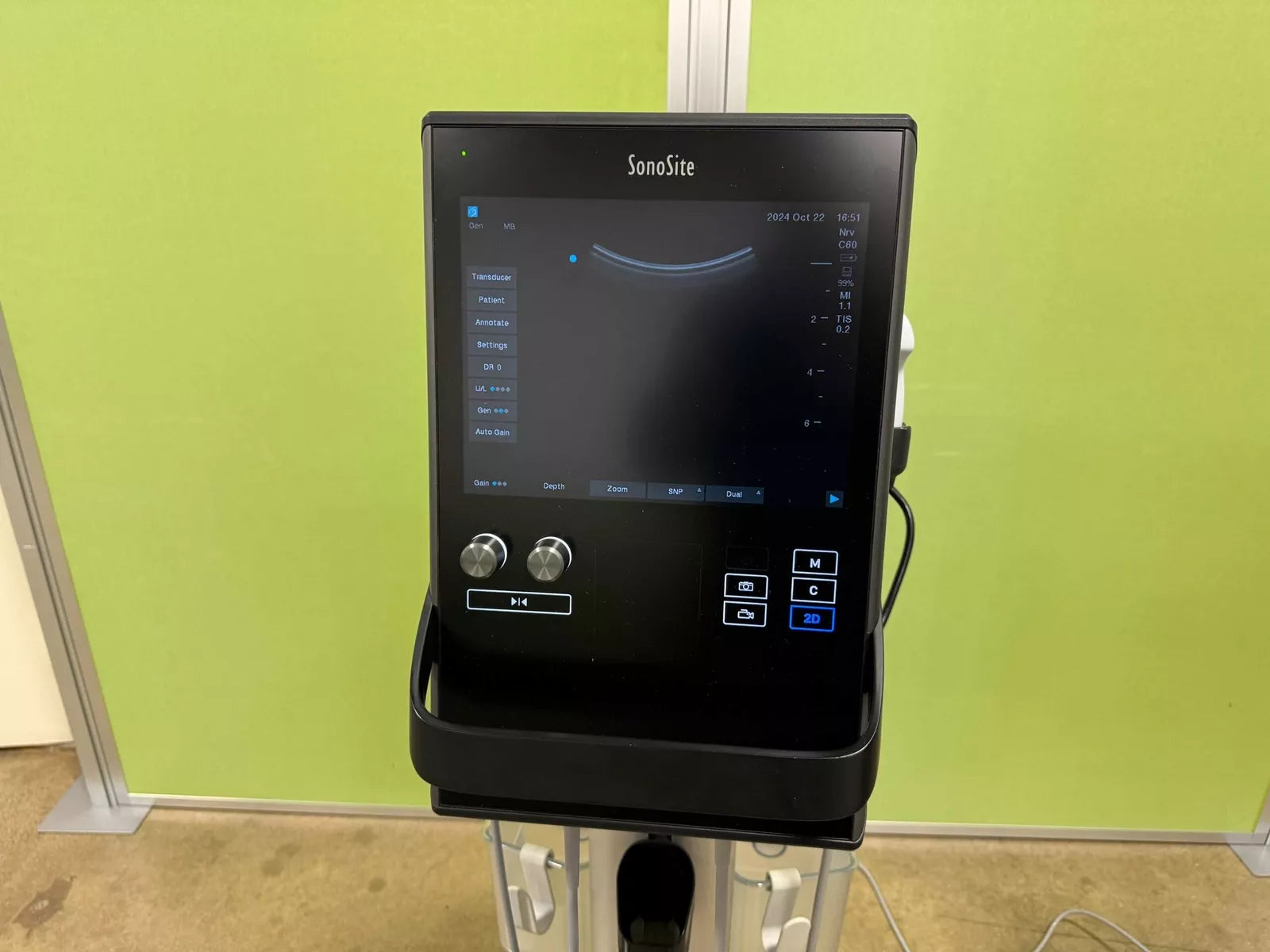 SonoSite S2 SII Ultrasound Machine