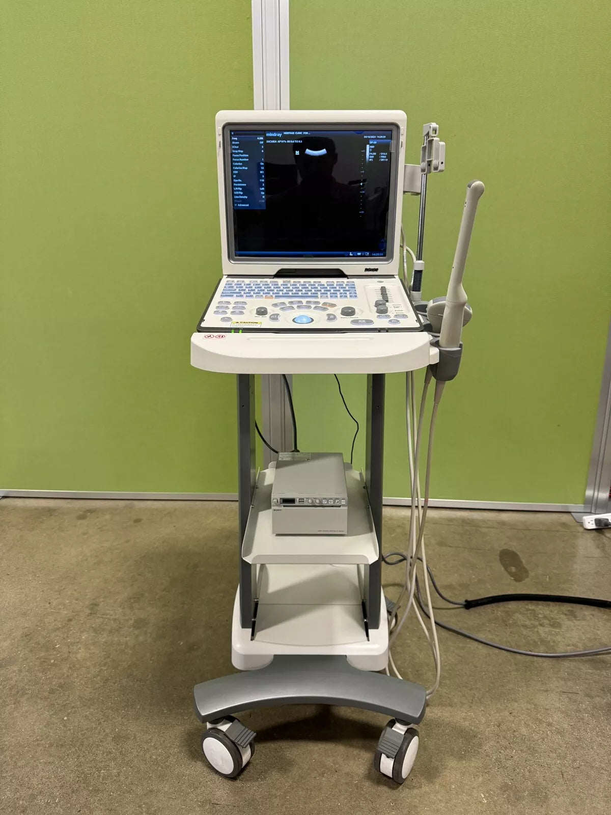 Mindray DP-50 Ultrasound System (Only Ultrasound Included)