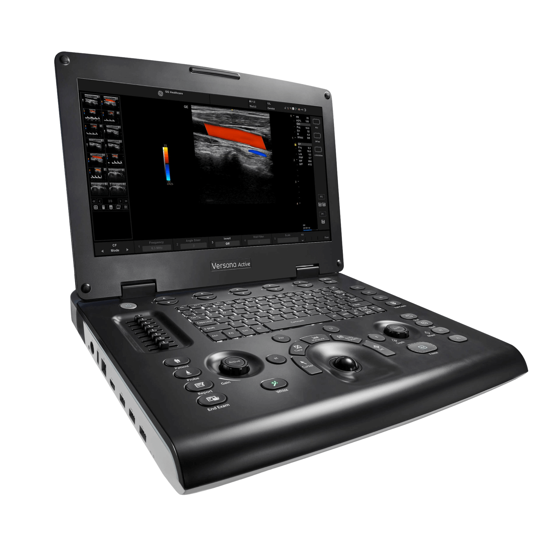 GE Versana Active™ Ultrasound System GEM H8041AB | QuinceMedical.com