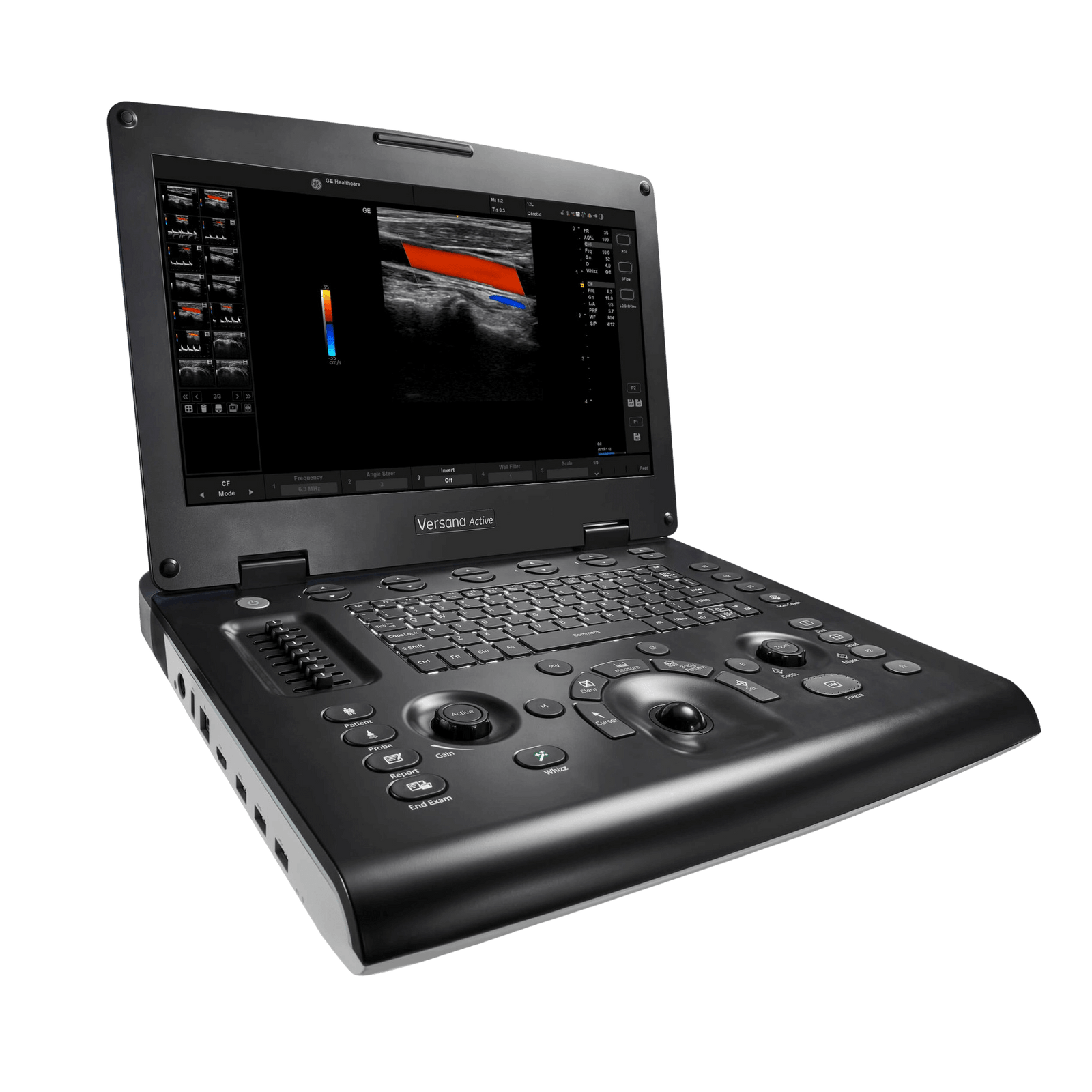 GE Versana Active™ Ultrasound System GEM H8041AB | QuinceMedical.com